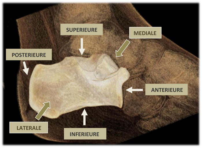 Imagerie pathologie arriere pied ANATOMIE DU CALCANEUS Imagerie pathologie arriere pied ANATOMIE DU CALCANEUS